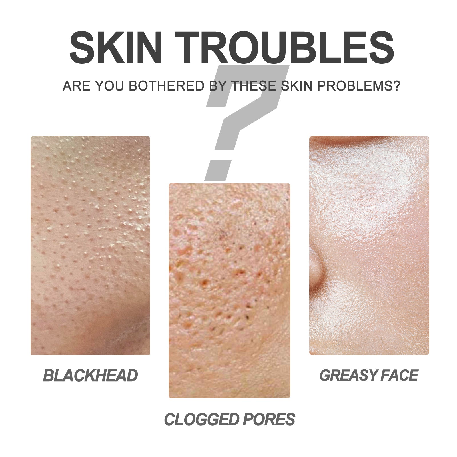 Blackhead Cleansing Cream Skin Oil Blackheads Acne Exfoliating Cleansing Repair Pore Tearing Nose Patch